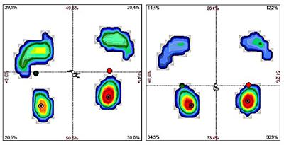 Managing Toe Walking, a Treatment Side Effect, in a Child With T-Cell Non-Hodgkin's Lymphoma: A Case Report